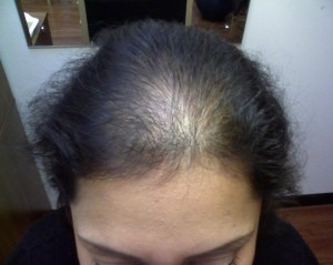 Clonazione capelli Clonazione capelli
