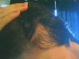 Diradamento capelli